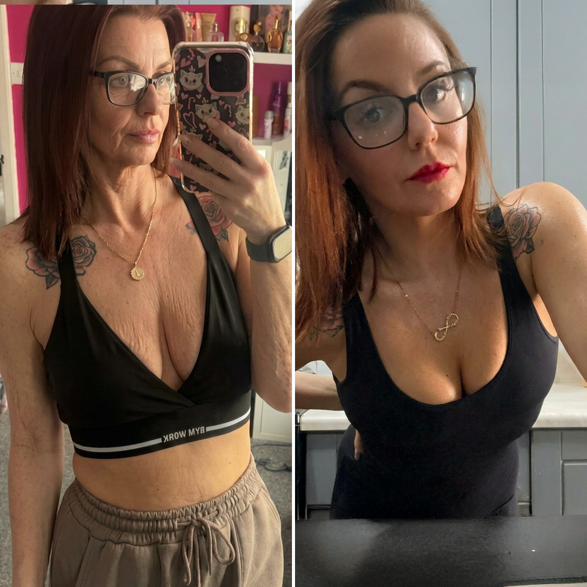 💞𝐻𝐼𝑆𝐾𝐼𝑁® Mikroneedlová náplast pro podporu objemu, lifting a pevnost prsou-pro plnější, pevnější a krásněji tvarovaný dekolt | Jednoduchý každodenní rituál péče o poprsí ✨
