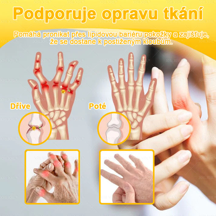 XRLXRL® Krém na úlevu od bolesti a hojení kostí s včelím jedem