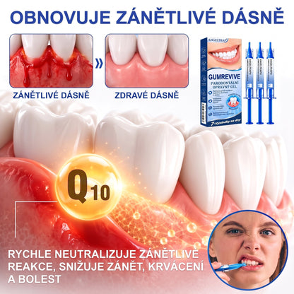 🇨🇿 🦷 𝐀𝐍𝐆𝐄𝐋𝐓𝐑𝐀𝐏®  𝐎𝐛𝐧𝐨𝐯𝐚 𝐝á𝐬𝐧í 𝐩𝐚𝐫𝐨𝐝𝐨𝐧𝐭á𝐥𝐧í 𝐨𝐩𝐫𝐚𝐯𝐧ý 𝐠𝐞