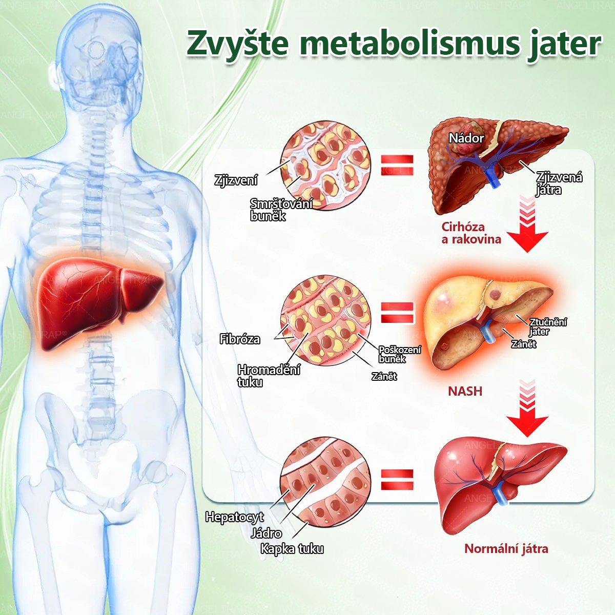 ⚡ Speciální nabídka – sleva 50 % jen dnes! 🏥 𝑨𝑵𝑮𝑬𝑳𝑻𝑹𝑨𝑷® 10-in-1 nano mikrojihlová náplast 🍃 Podpora metabolismu · energie · rovnováhy ⏰ Nezmeškejte – přidejte do košíku nyní!