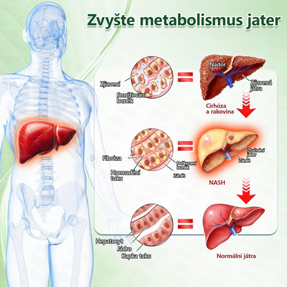 ⚡ Speciální nabídka – sleva 50 % jen dnes! 🏥 𝑨𝑵𝑮𝑬𝑳𝑻𝑹𝑨𝑷® 10-in-1 nano mikrojihlová náplast 🍃 Podpora metabolismu · energie · rovnováhy ⏰ Nezmeškejte – přidejte do košíku nyní!