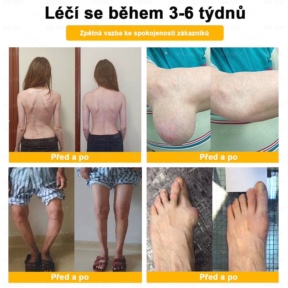 XRLXRL® Krém na úlevu od bolesti a hojení kostí s včelím jedem