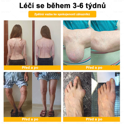 XRLXRL® Krém na úlevu od bolesti a hojení kostí s včelím jedem