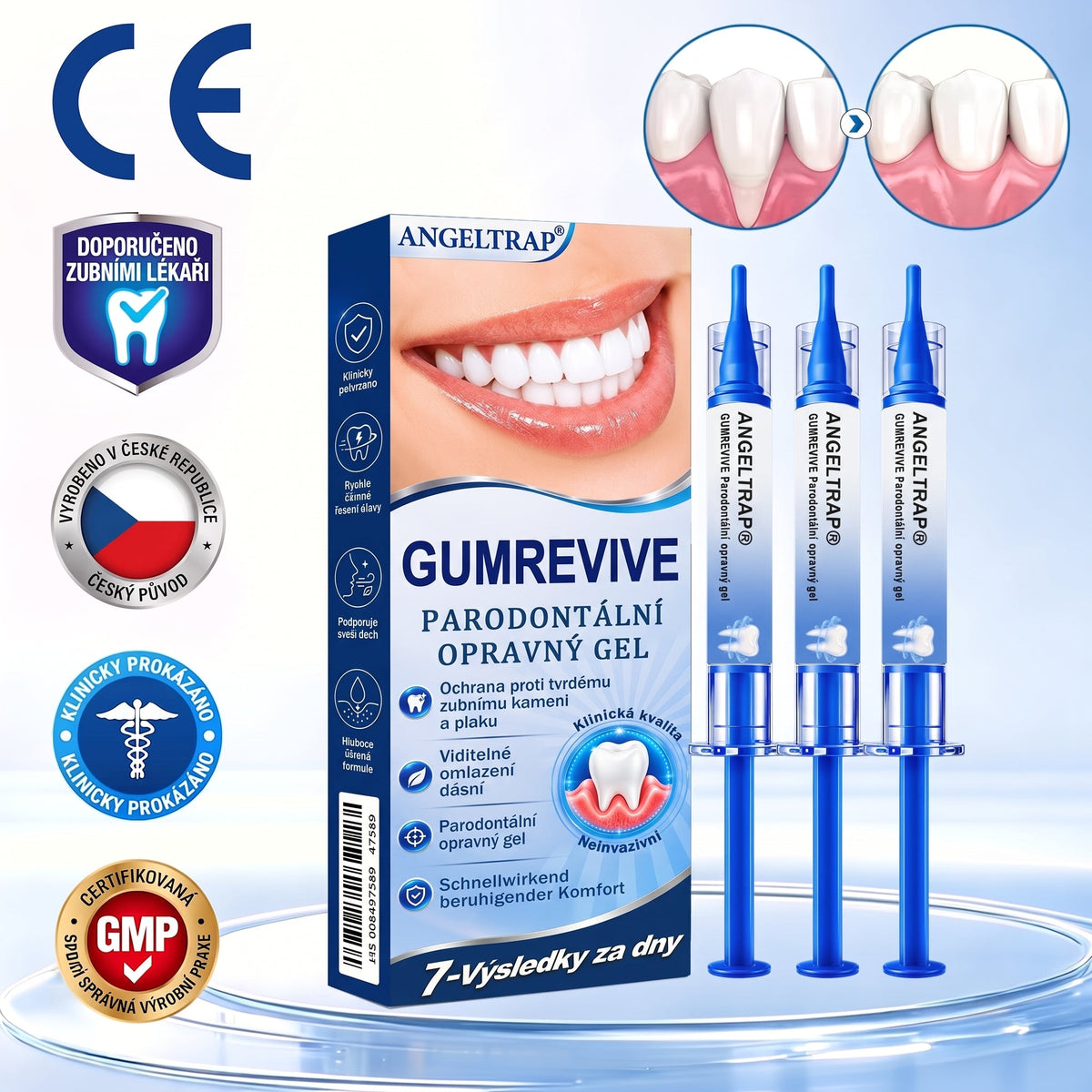 🇨🇿 🦷 𝐀𝐍𝐆𝐄𝐋𝐓𝐑𝐀𝐏®  𝐎𝐛𝐧𝐨𝐯𝐚 𝐝á𝐬𝐧í 𝐩𝐚𝐫𝐨𝐝𝐨𝐧𝐭á𝐥𝐧í 𝐨𝐩𝐫𝐚𝐯𝐧ý 𝐠𝐞