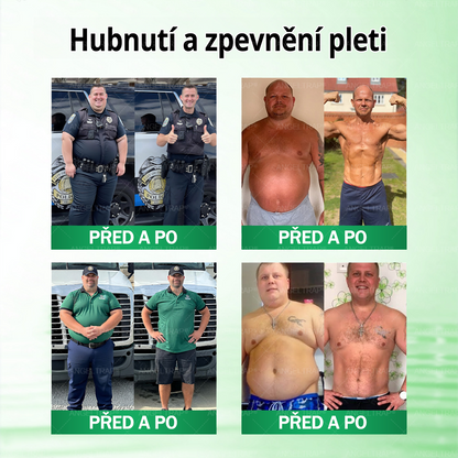 ⚡ Speciální nabídka – sleva 50 % jen dnes! 🏥 𝑨𝑵𝑮𝑬𝑳𝑻𝑹𝑨𝑷® 10-in-1 nano mikrojihlová náplast 🍃 Podpora metabolismu · energie · rovnováhy ⏰ Nezmeškejte – přidejte do košíku nyní!