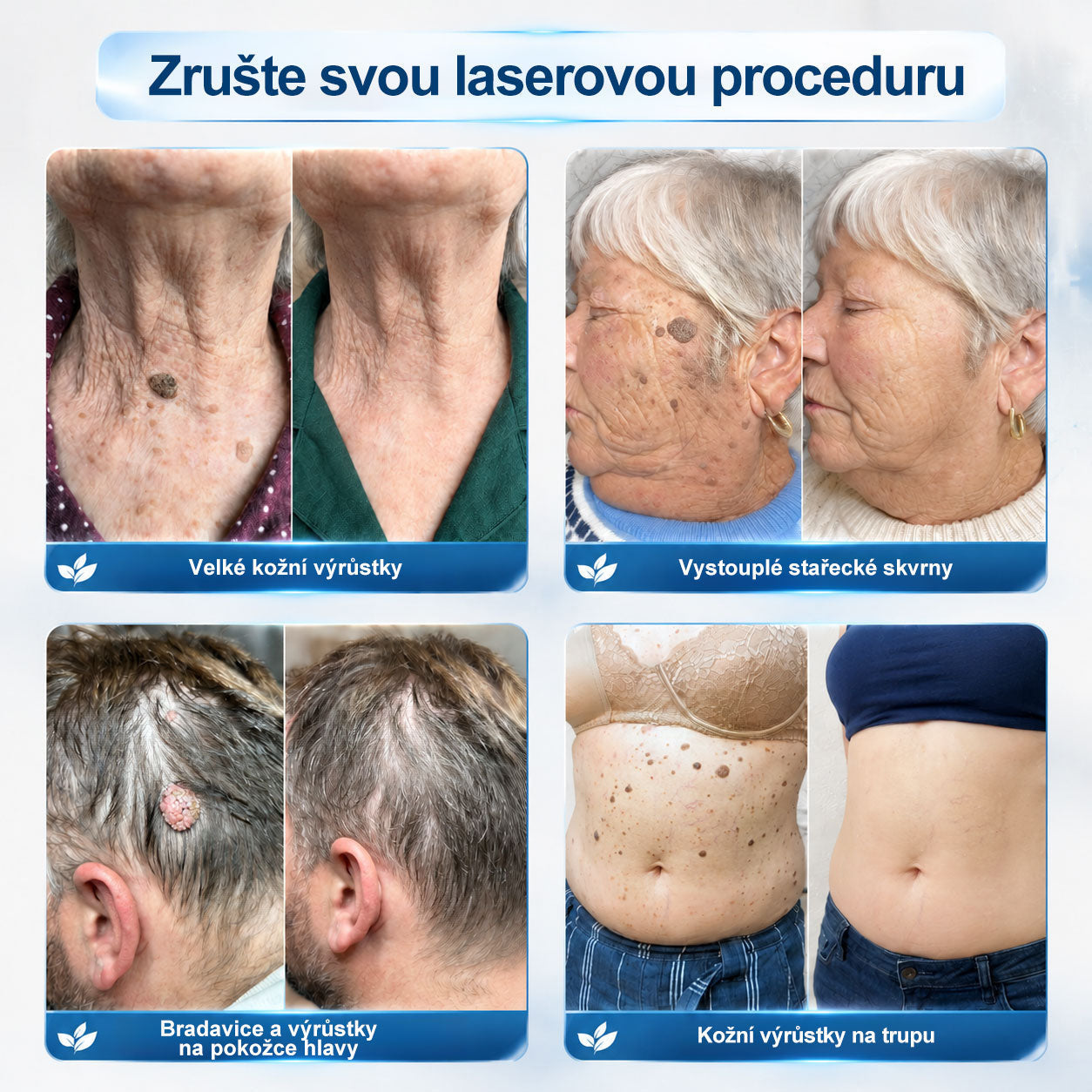 💛✅Oficiální značkový obchod | Hiskin® 7denní odstraňovač skvrn a pigmentových skvrn (Bezbolestný rollerball bez jizev)🐬