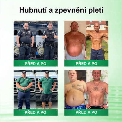 🇨🇿 Oficiální obchod | 💎💎 Yanse® Moringa · Berberin x NAD+ 10 v 1 náplast (aplikace jednou denně, viditelné výsledky po 7 dnech) ✅ Používá se k léčbě obezity, ochablé pleti, diabetu, spánkové apnoe a poruch chuti.