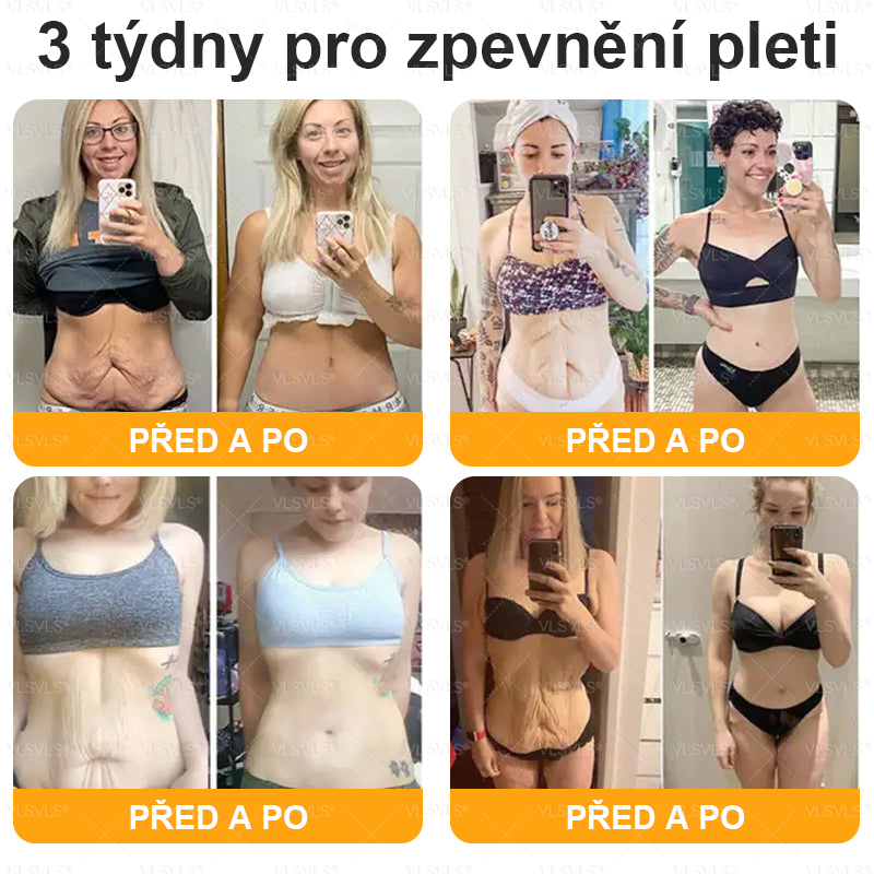 👩‍⚕️✨VLSVLS® Krém s včelím jedem Kompletní péče POSLEDNÍ DEN 80% SLEVA (Odlévání pleti, jemné vrásky, ztráta pevnosti, plochý dekolt, klesající boky a další)
