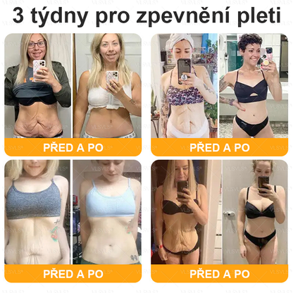 👩‍⚕️✨VLSVLS® Krém s včelím jedem Kompletní péče POSLEDNÍ DEN 80% SLEVA (Odlévání pleti, jemné vrásky, ztráta pevnosti, plochý dekolt, klesající boky a další)