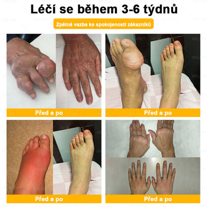 XRLXRL® Krém na úlevu od bolesti a hojení kostí s včelím jedem