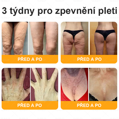 👩‍⚕️✨VLSVLS® Krém s včelím jedem Kompletní péče POSLEDNÍ DEN 80% SLEVA (Odlévání pleti, jemné vrásky, ztráta pevnosti, plochý dekolt, klesající boky a další)