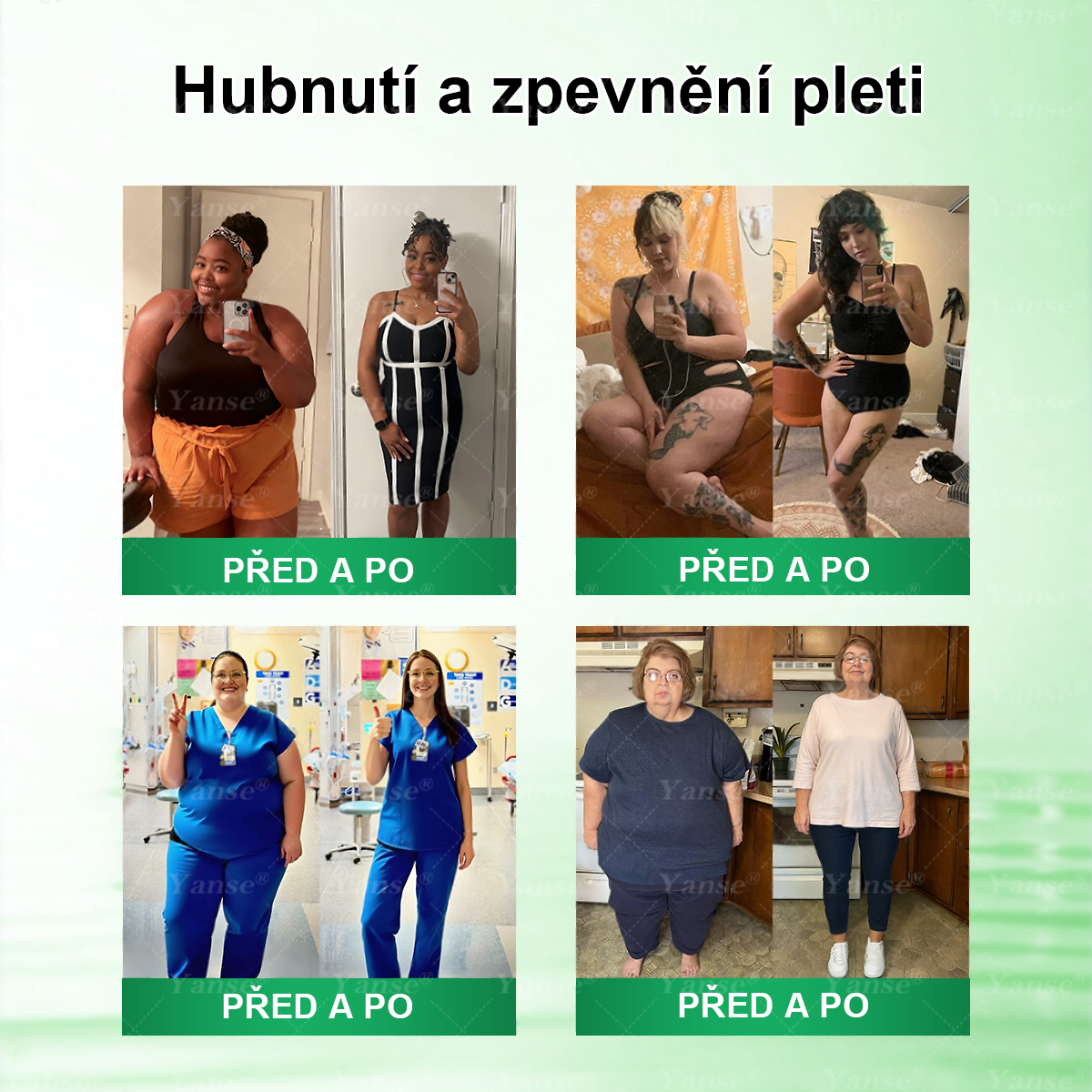 🇨🇿 Oficiální obchod | 💎💎 Yanse® Moringa · Berberin x NAD+ 10 v 1 náplast (aplikace jednou denně, viditelné výsledky po 7 dnech) ✅ Používá se k léčbě obezity, ochablé pleti, diabetu, spánkové apnoe a poruch chuti.