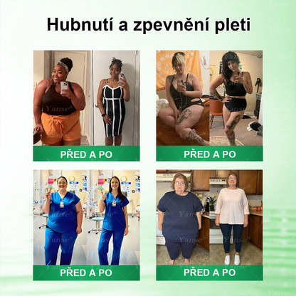 🇨🇿 Oficiální obchod | 💎💎 Yanse® Moringa · Berberin x NAD+ 10 v 1 náplast (aplikace jednou denně, viditelné výsledky po 7 dnech) ✅ Používá se k léčbě obezity, ochablé pleti, diabetu, spánkové apnoe a poruch chuti.