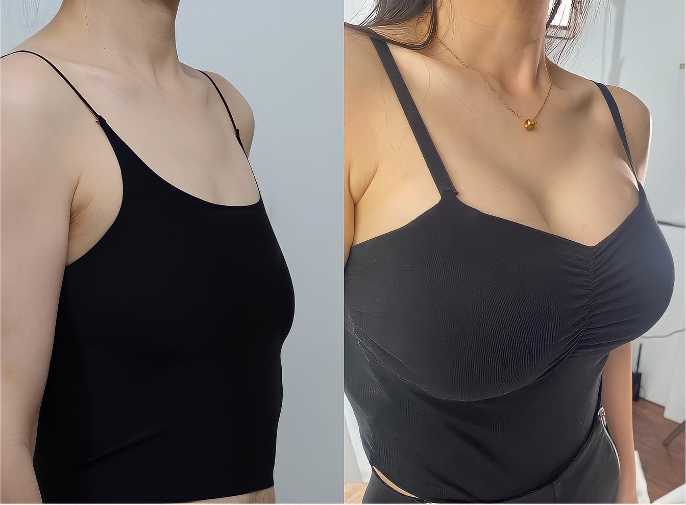 💞𝐻𝐼𝑆𝐾𝐼𝑁® Mikroneedlová náplast pro podporu objemu, lifting a pevnost prsou-pro plnější, pevnější a krásněji tvarovaný dekolt | Jednoduchý každodenní rituál péče o poprsí ✨