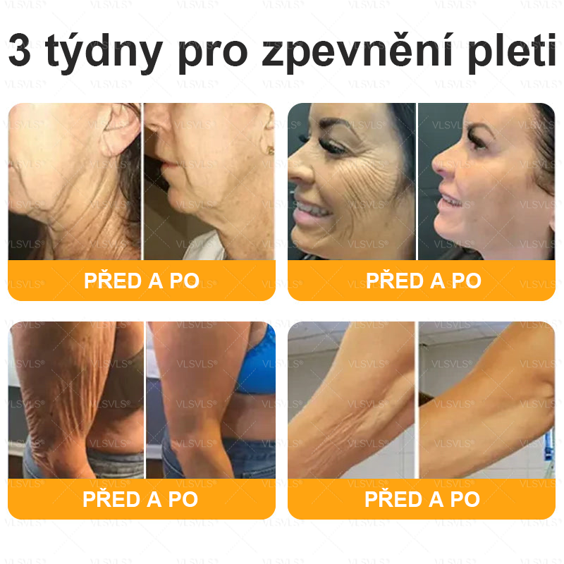 👩‍⚕️✨VLSVLS® Krém s včelím jedem Kompletní péče POSLEDNÍ DEN 80% SLEVA (Odlévání pleti, jemné vrásky, ztráta pevnosti, plochý dekolt, klesající boky a další)