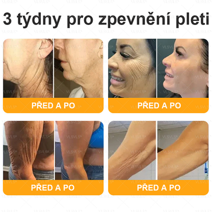 👩‍⚕️✨VLSVLS® Krém s včelím jedem Kompletní péče POSLEDNÍ DEN 80% SLEVA (Odlévání pleti, jemné vrásky, ztráta pevnosti, plochý dekolt, klesající boky a další)