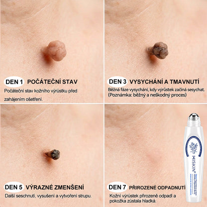 💛✅Oficiální značkový obchod | Hiskin® 7denní odstraňovač skvrn a pigmentových skvrn (Bezbolestný rollerball bez jizev)🐬