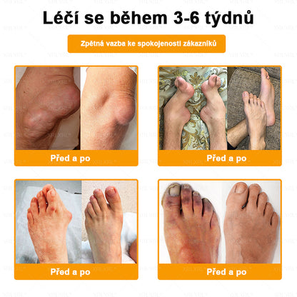 XRLXRL® Krém na úlevu od bolesti a hojení kostí s včelím jedem