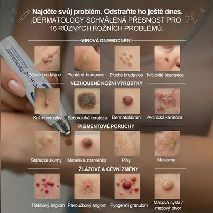 💛✅Oficiální značkový obchod | Hiskin® 7denní odstraňovač skvrn a pigmentových skvrn (Bezbolestný rollerball bez jizev)🐬