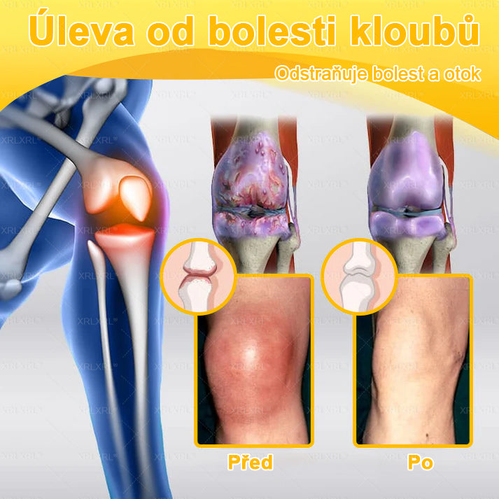 XRLXRL® Krém na úlevu od bolesti a hojení kostí s včelím jedem