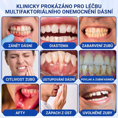 🇨🇿 🦷 𝐀𝐍𝐆𝐄𝐋𝐓𝐑𝐀𝐏®  𝐎𝐛𝐧𝐨𝐯𝐚 𝐝á𝐬𝐧í 𝐩𝐚𝐫𝐨𝐝𝐨𝐧𝐭á𝐥𝐧í 𝐨𝐩𝐫𝐚𝐯𝐧ý 𝐠𝐞