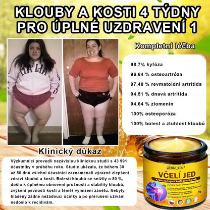 XRLXRL® Krém na úlevu od bolesti a hojení kostí s včelím jedem