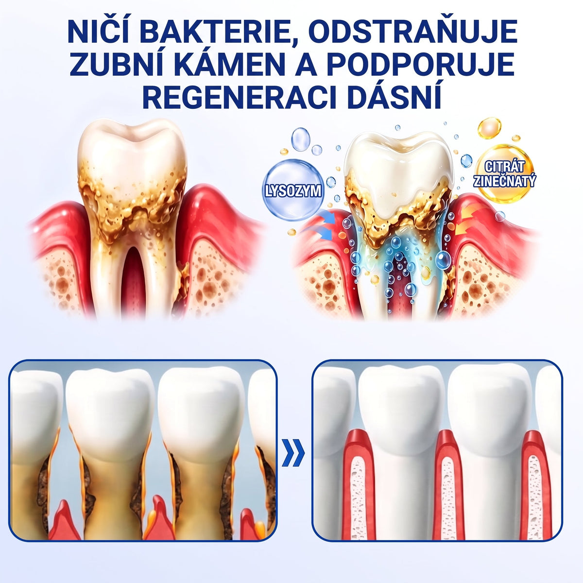 🇨🇿 🦷 𝐀𝐍𝐆𝐄𝐋𝐓𝐑𝐀𝐏®  𝐎𝐛𝐧𝐨𝐯𝐚 𝐝á𝐬𝐧í 𝐩𝐚𝐫𝐨𝐝𝐨𝐧𝐭á𝐥𝐧í 𝐨𝐩𝐫𝐚𝐯𝐧ý 𝐠𝐞
