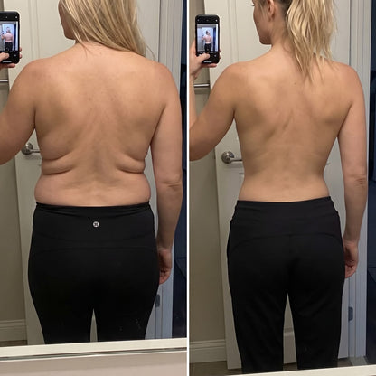💞𝐻𝐼𝑆𝐾𝐼𝑁® Mikroneedlová náplast pro podporu objemu, lifting a pevnost prsou-pro plnější, pevnější a krásněji tvarovaný dekolt | Jednoduchý každodenní rituál péče o poprsí ✨