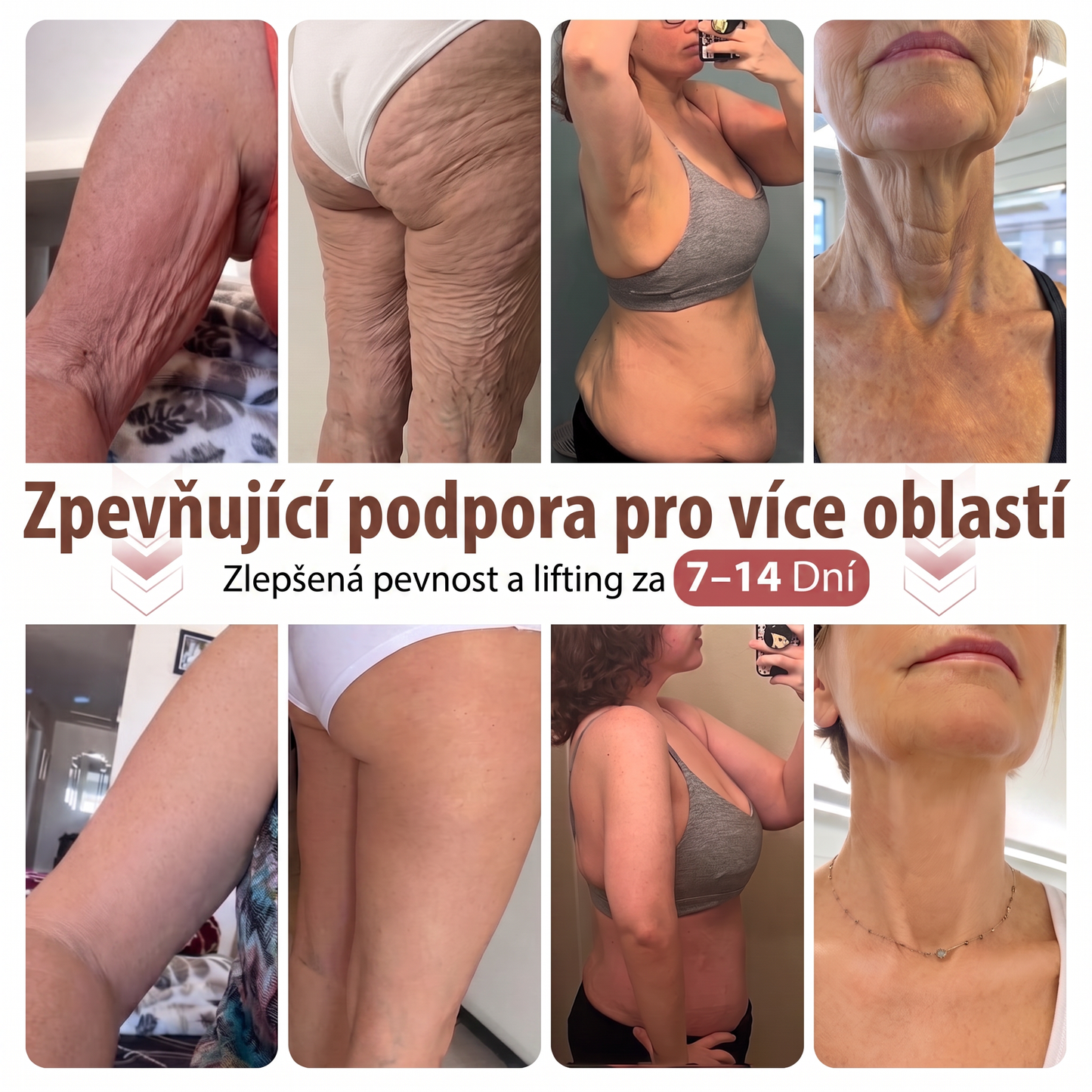 💞𝐻𝐼𝑆𝐾𝐼𝑁® Mikroneedlová náplast pro podporu objemu, lifting a pevnost prsou-pro plnější, pevnější a krásněji tvarovaný dekolt | Jednoduchý každodenní rituál péče o poprsí ✨