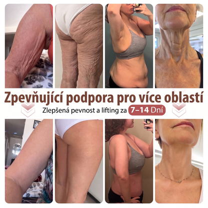 💞𝐻𝐼𝑆𝐾𝐼𝑁® Mikroneedlová náplast pro podporu objemu, lifting a pevnost prsou-pro plnější, pevnější a krásněji tvarovaný dekolt | Jednoduchý každodenní rituál péče o poprsí ✨