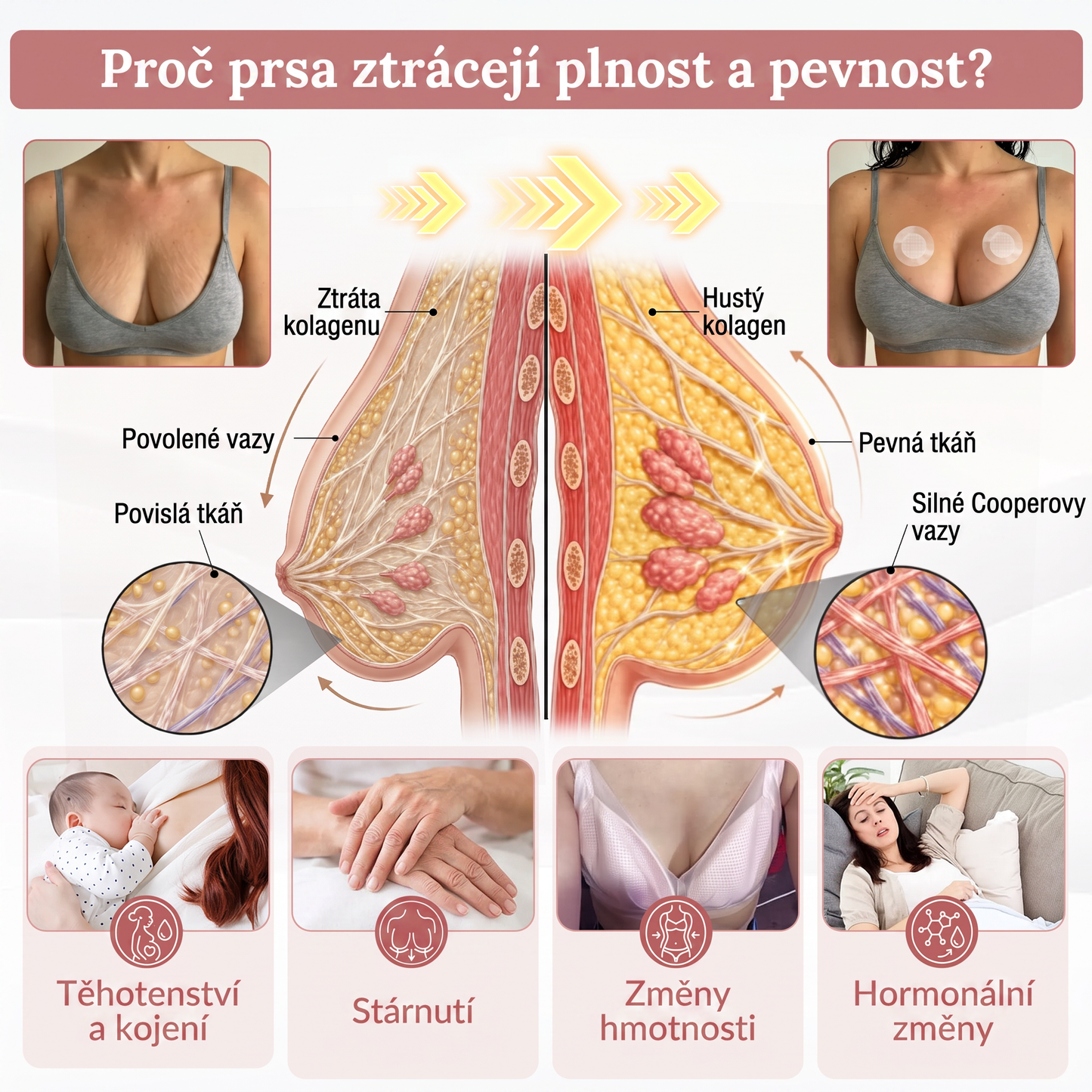 💞𝐻𝐼𝑆𝐾𝐼𝑁® Mikroneedlová náplast pro podporu objemu, lifting a pevnost prsou-pro plnější, pevnější a krásněji tvarovaný dekolt | Jednoduchý každodenní rituál péče o poprsí ✨