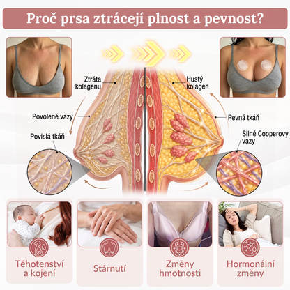 💞𝐻𝐼𝑆𝐾𝐼𝑁® Mikroneedlová náplast pro podporu objemu, lifting a pevnost prsou-pro plnější, pevnější a krásněji tvarovaný dekolt | Jednoduchý každodenní rituál péče o poprsí ✨